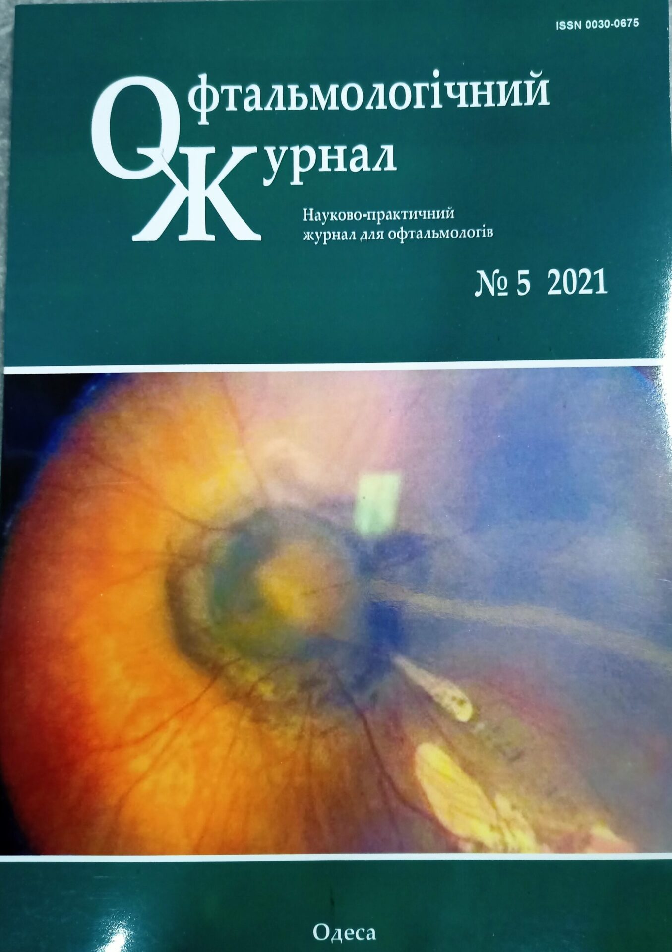 Офтальмологічний журнал